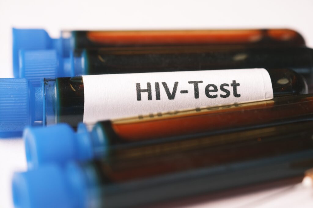 Prevent HIV with tests
